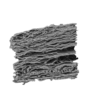 Collagen membrane